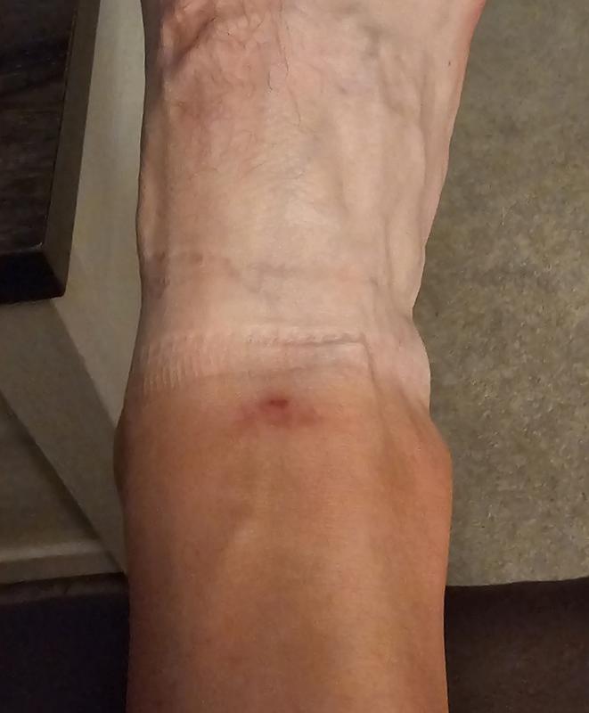 Photo submitted with review of product