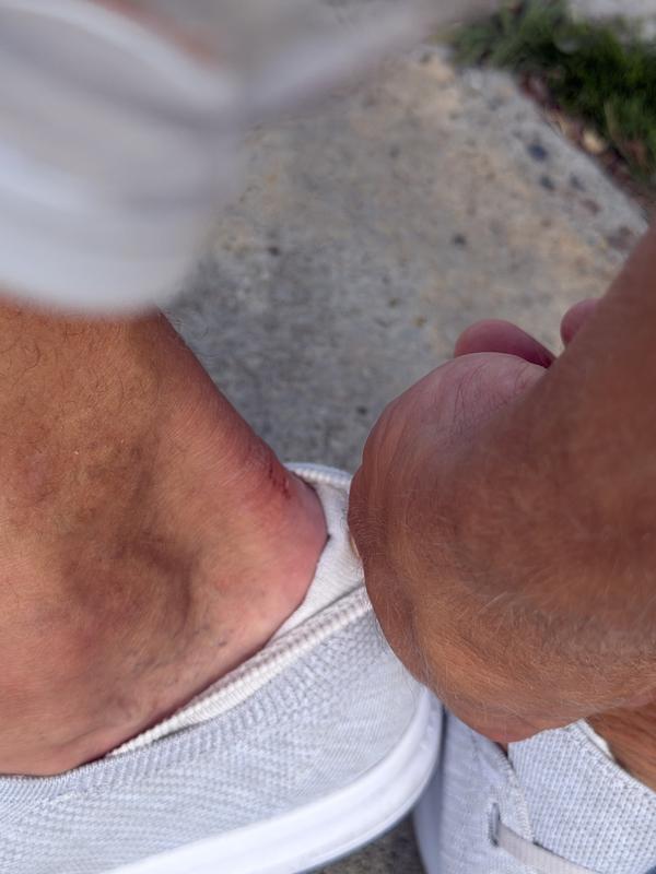 Customer photo for "Nice but rubbing on heels"