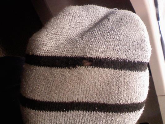 Developing hole; the end is nigh.