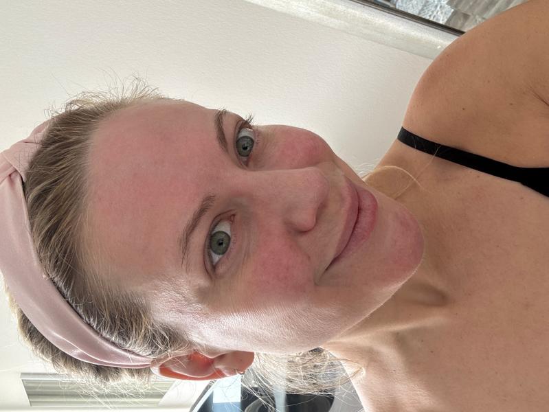 Customer photo for "The product I was missing. No more whitecast!"