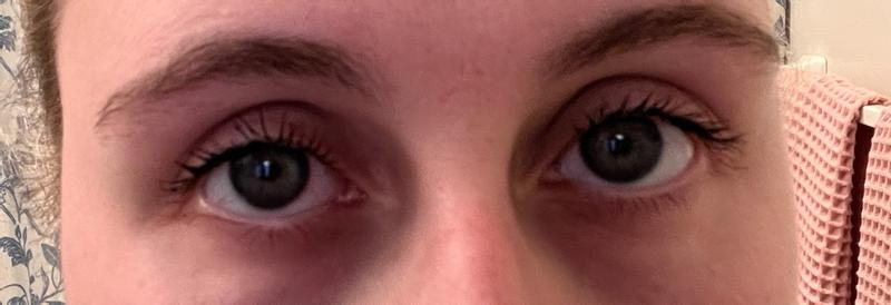 Customer carousel item 11.