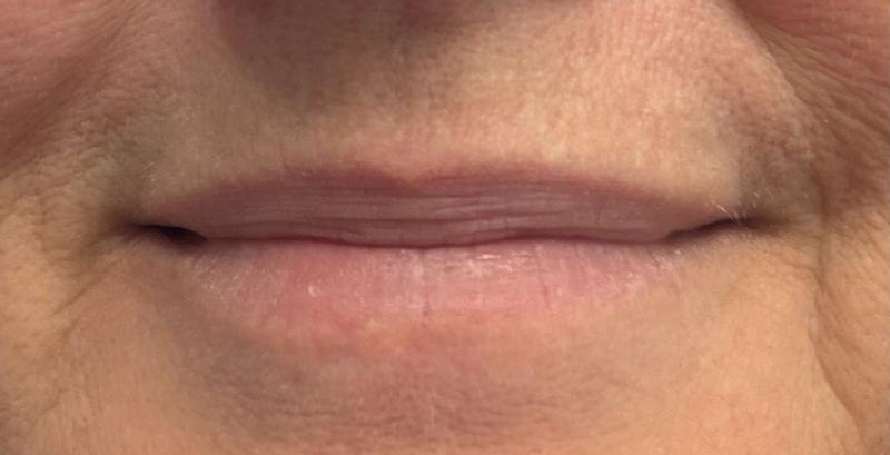 Customer carousel item 14.