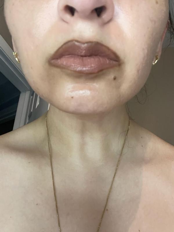 Customer carousel item 11.