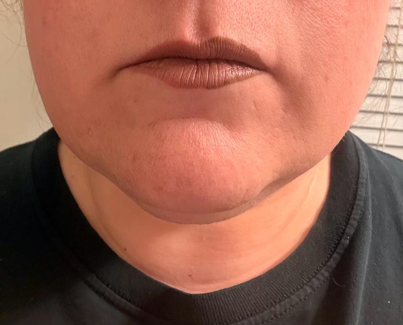 Customer carousel item 1.