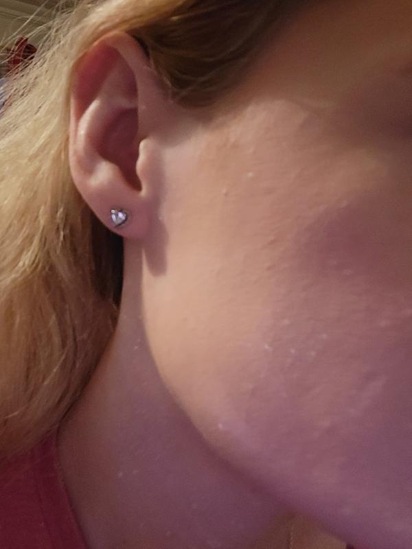 White specks on face & leggings