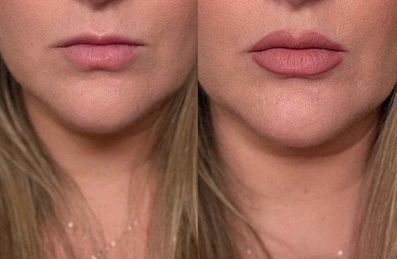 Customer carousel item 1.