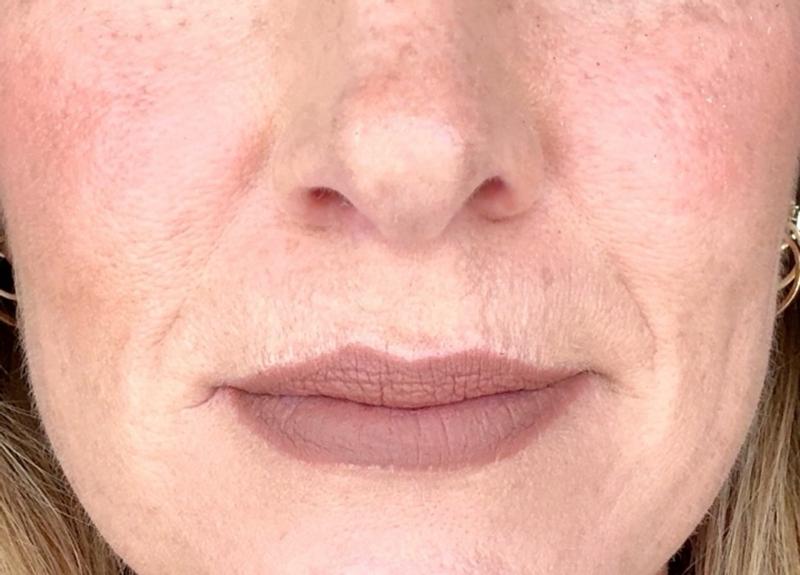 Customer carousel item 7.