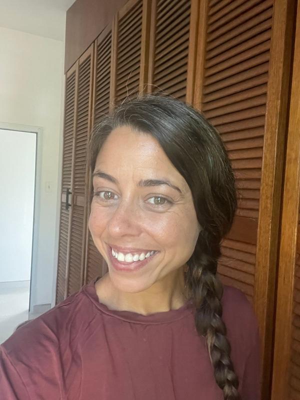 Customer photo for "Best Eye Cream! Noticed results in ONE week!"