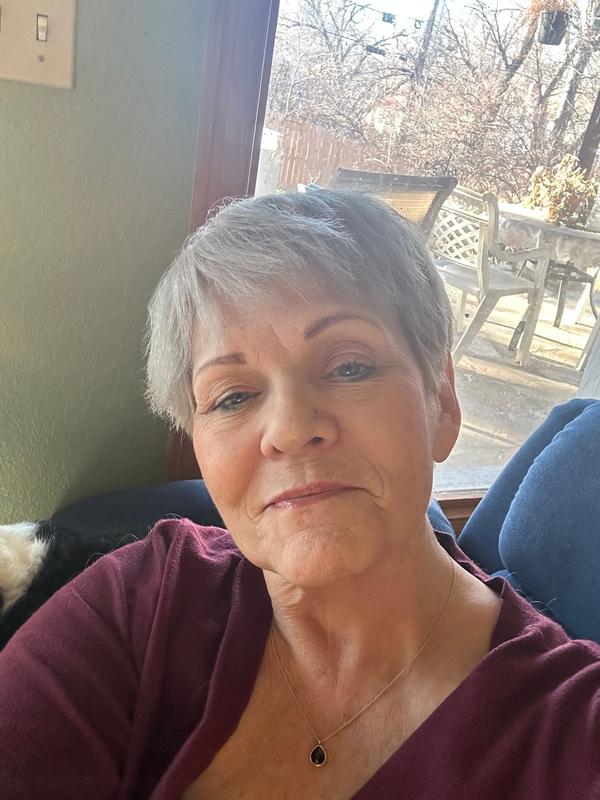 Customer photo for "Eye Cream"