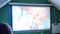 ACER E100-W01MW 100'' (254 CM)