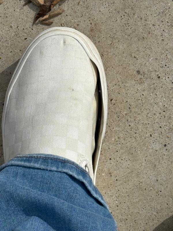 Both shoes have this same issue