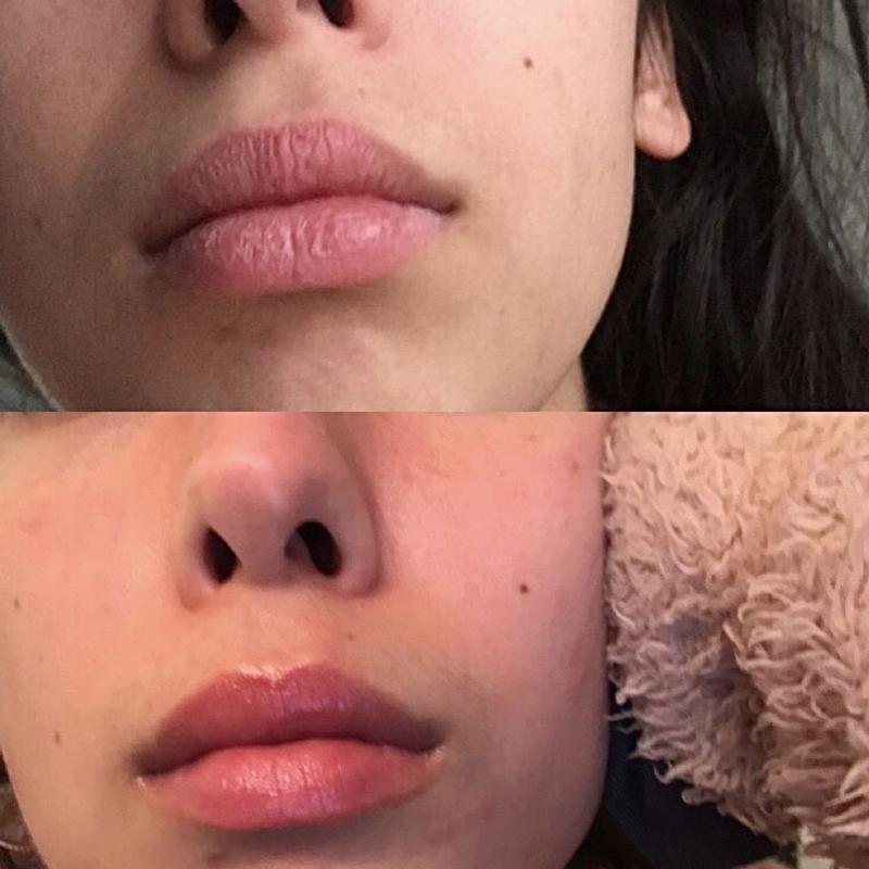 Vaseline Lip Therapy Rosy Lips Review Indonesia