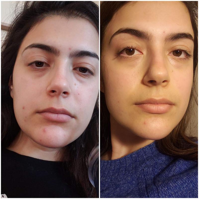 just breathe clarifying serum versed