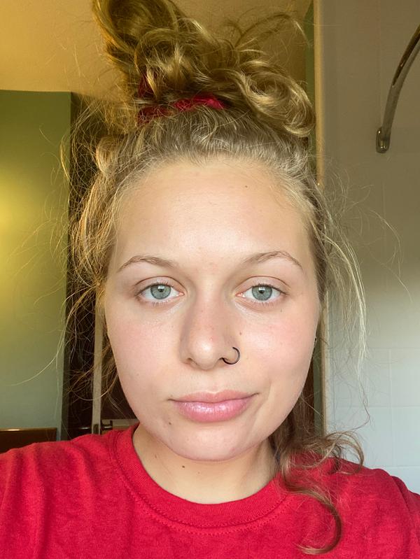 versed sulfur spot treatment