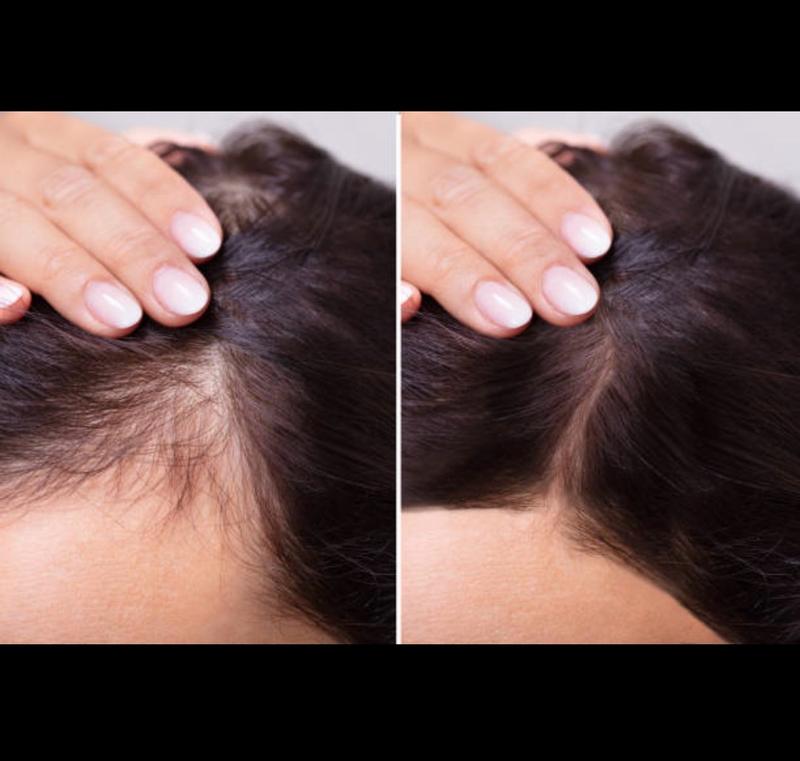 Customer carousel item 1.