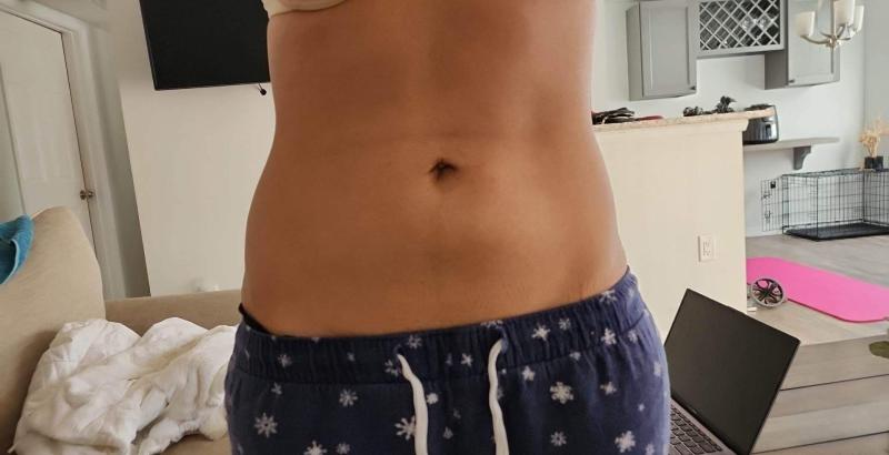 My arm pain has decreased!