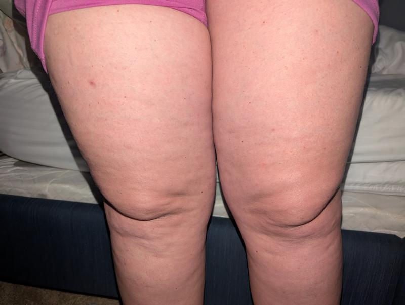 After 4 months of consistent daily use