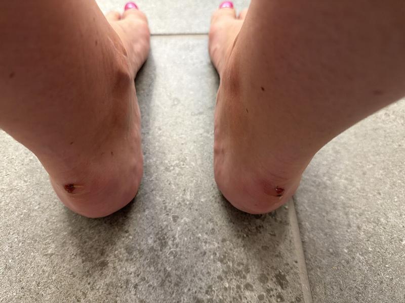 Customer photo for "Caused terrible blisters on walk"
