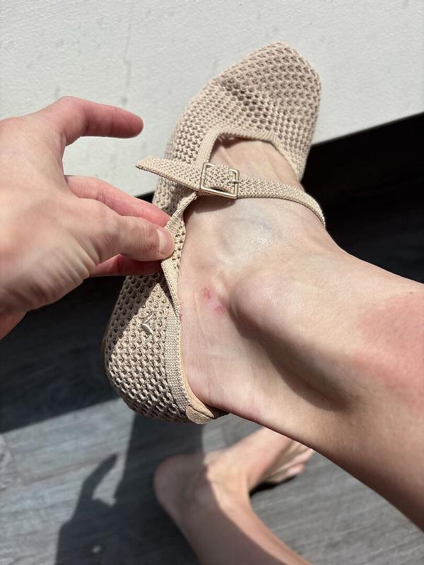 Customer photo for "Blisters after 1 mile"