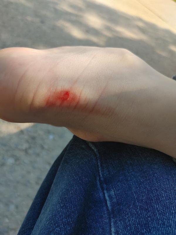 Customer photo for "Cute! But now my heels are bleeding"