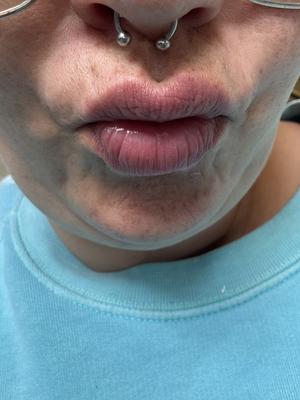 Annastcia's photo of the New Look, Same Formula! Lip Glow Sheer Lip Oil. Photo 1 of 1. Bild-Bewertung geteilt von Annastcia