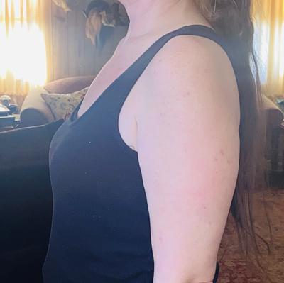April's photo of the Unlined Wireless Posture Corrector Bra. Photo 2 of 2