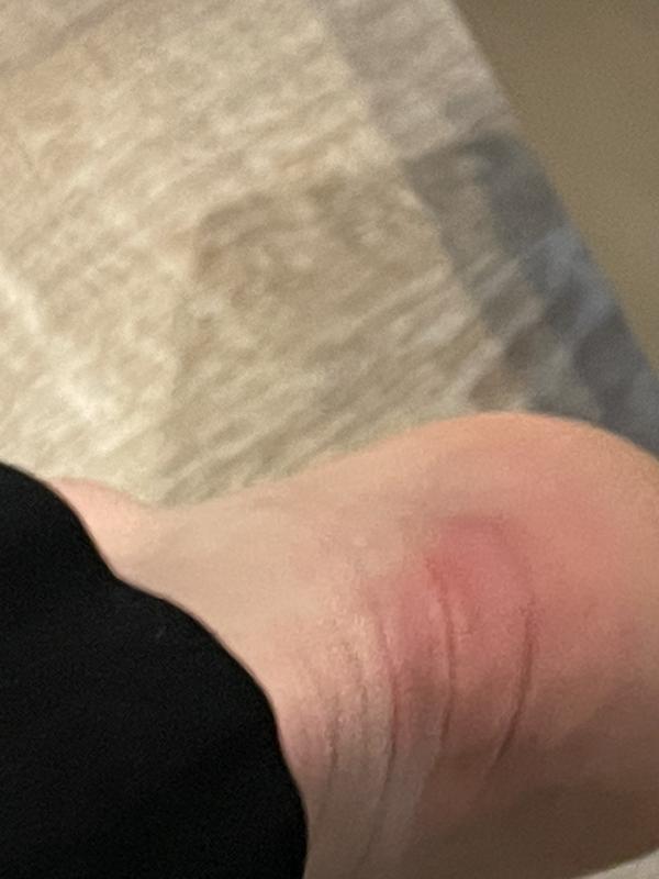 Heel blister