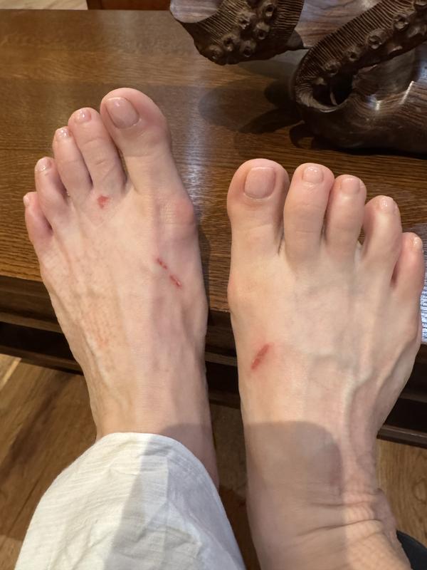OUCH!!!!