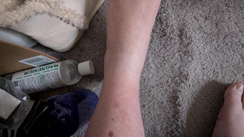 Rubbed areas in red. White area was squeezed