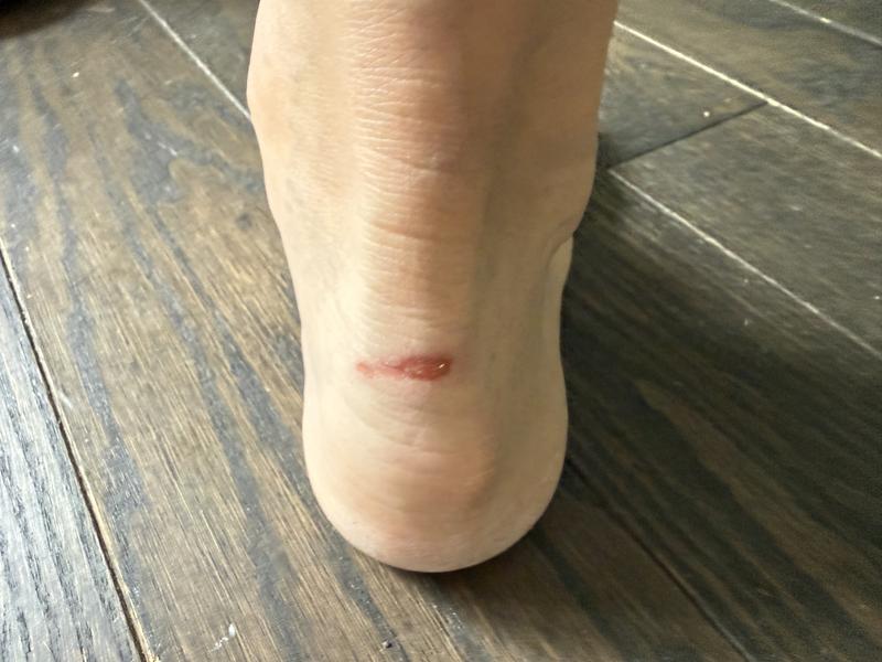 Customer photo for "Incredibly painful!"
