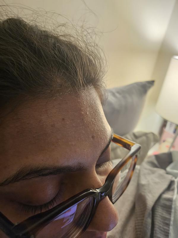 Customer photo for "Skin reaction after using it"