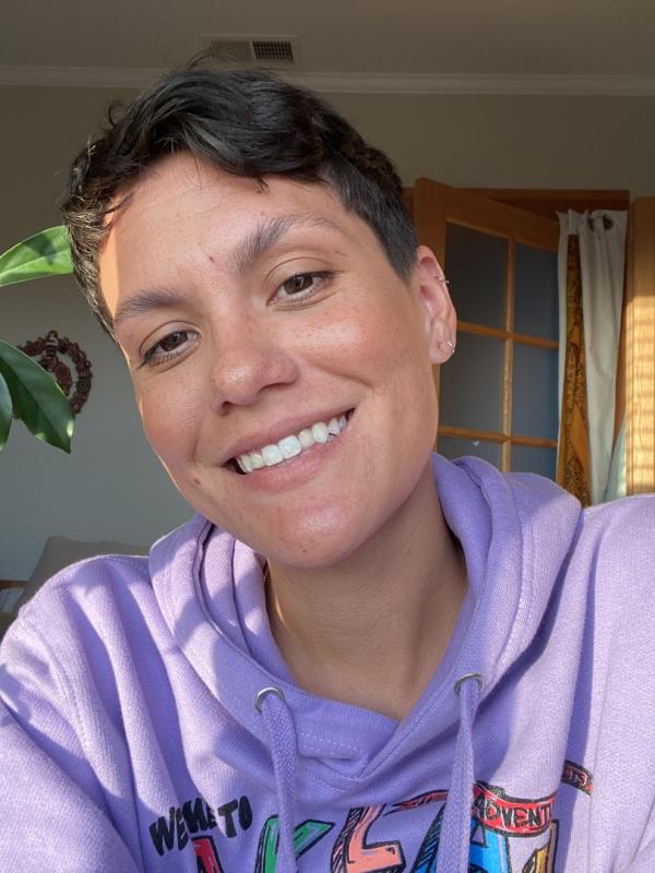 Customer photo for "Bye Mask Acne!"