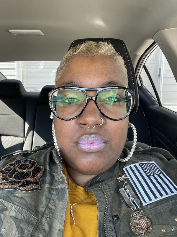 Customer photo for "The Best Face Oil Period!"