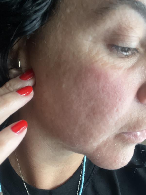 Customer photo for "Horrible"