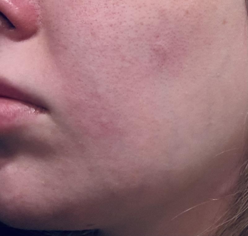 Customer photo for "Bad reaction"