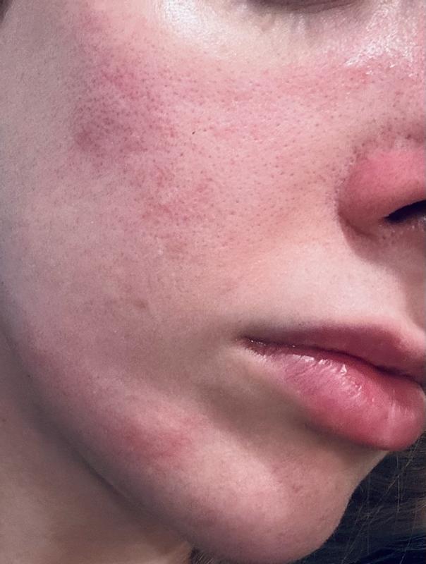 Customer photo for "Bad reaction"