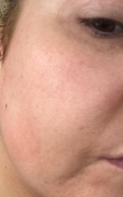 After using Moisture Glow