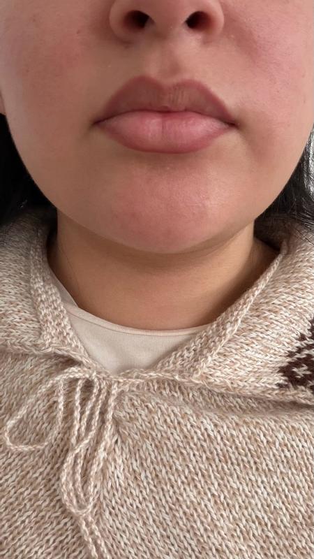 Review Thumbnail Image 0 249052732