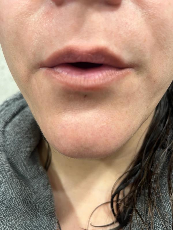 Review Thumbnail Image 2 249109861