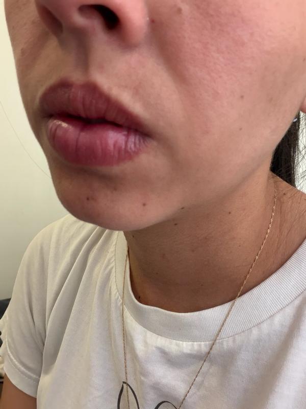 Review Thumbnail Image 1 249369875