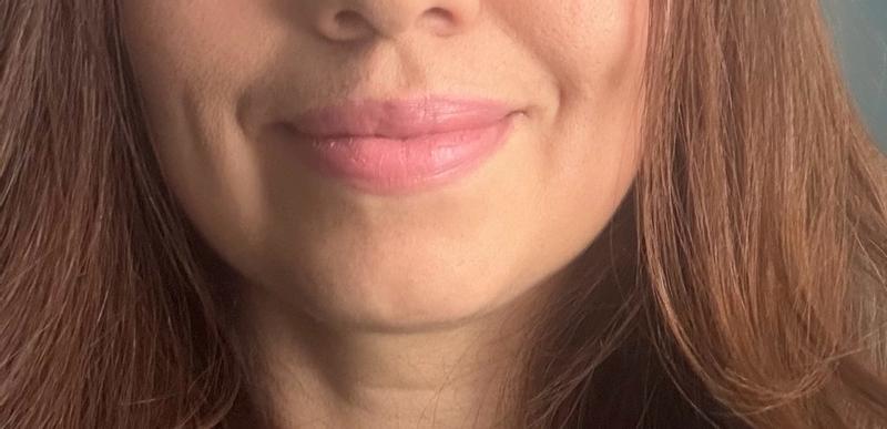 Review Thumbnail Image 1 248975988