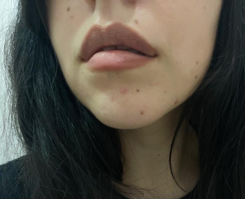 Review Thumbnail Image 1 248755453