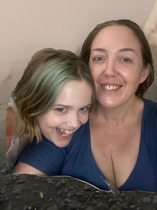 Who’s got the best skin now?